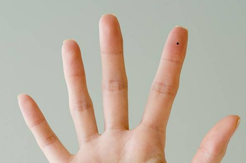 右手食指第一关节有痣的女生 右手食指第一关节有痣代表什么女人