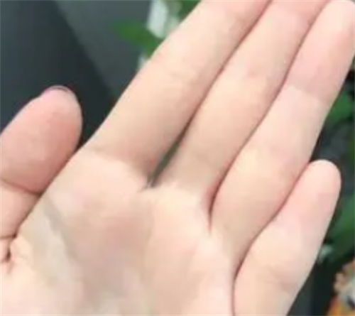 小拇指短代表什么意思 小拇指短有什么说法