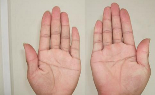 掌纹的三条线代表什么图解 女右手掌纹的三条线代表什么