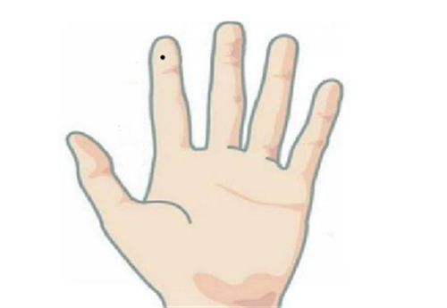 左手食指长了一颗痣代表什么意思 左手的食指长痣有什么寓意