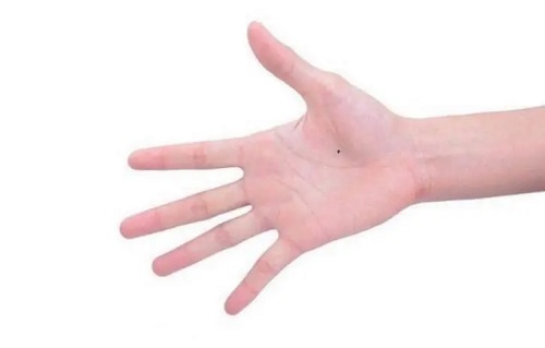 痣在手上的位置所代表的意义 男人手掌痣各个位置图解